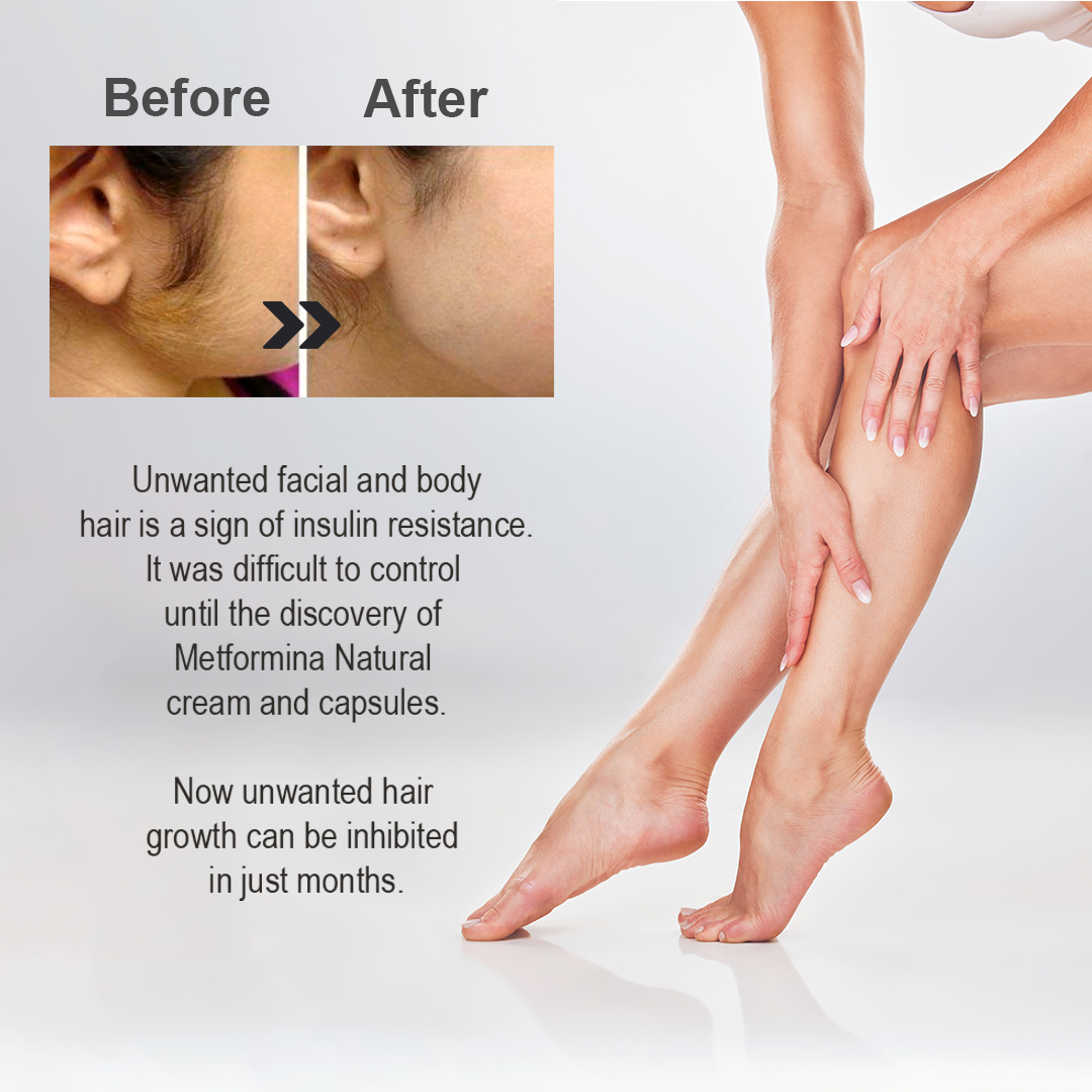 Metformina Natural - Crema Auxiliar en la Reducción de Vello Facial y Corporal (crema para 2 meses) Dr Salomon