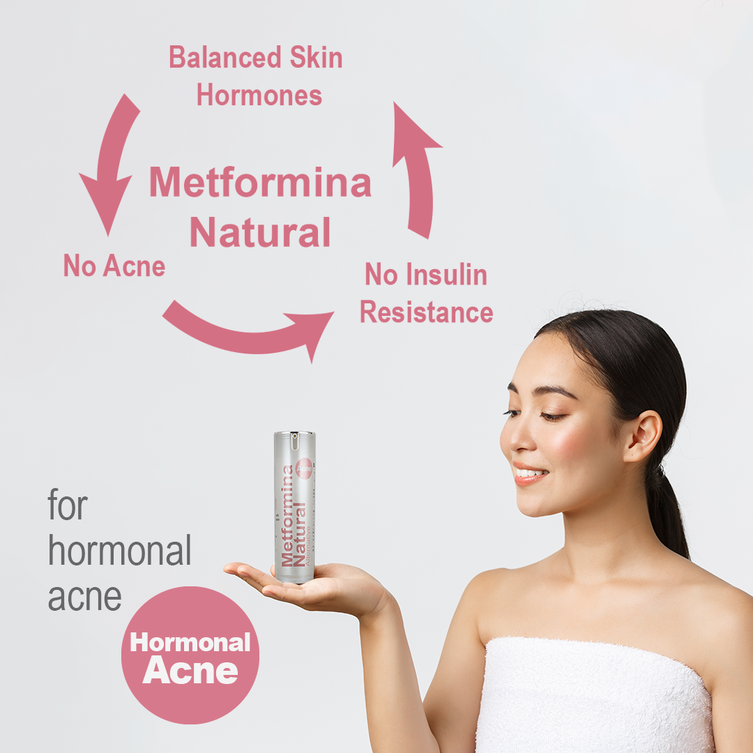 Metformina Natural - Crema para el Control Hormonal del Acné (crema para 2 meses) Dr Salomon